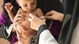 80% dzieci w Jemenie wymaga pomocy humanitarnej. Najmłodsi umierają z głodu